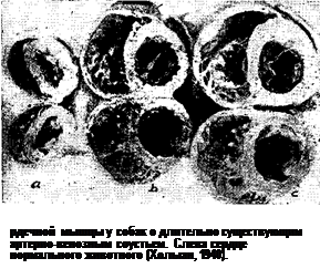 Поражения миокарда, вызываемые токсинами микробов