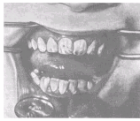 Развитие зубов у детей